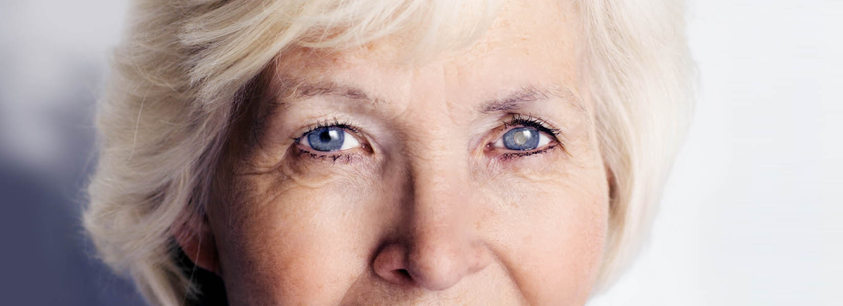 Cataract Surgery in Bellevue