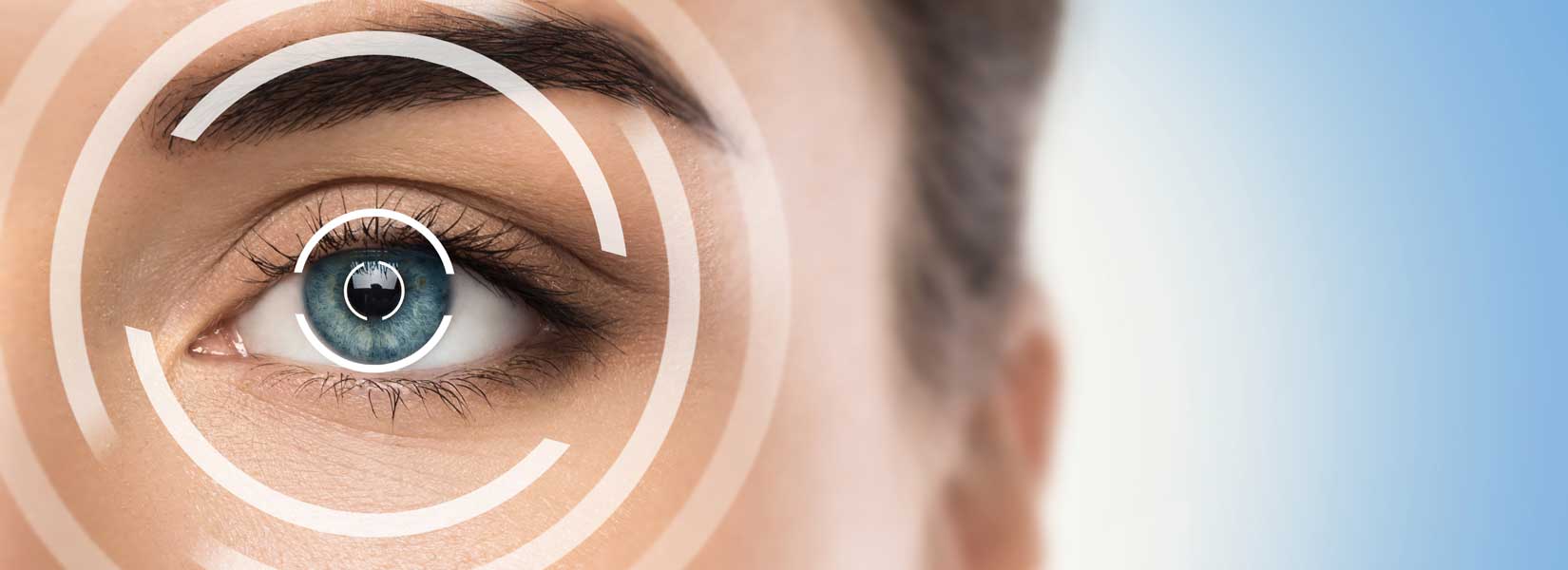 LASIK & Refractive Surgery Co-Management in Bellevue